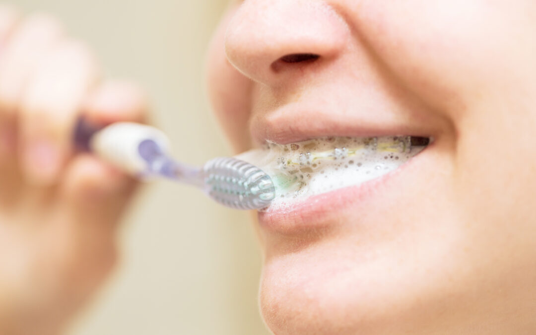 Tandenpoetsen met een beugel - orthodontist Den Haag Ortho Laak